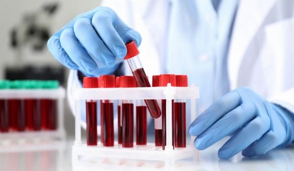 Pathology collector holding a blood sample tube above a rack of blood test tubes